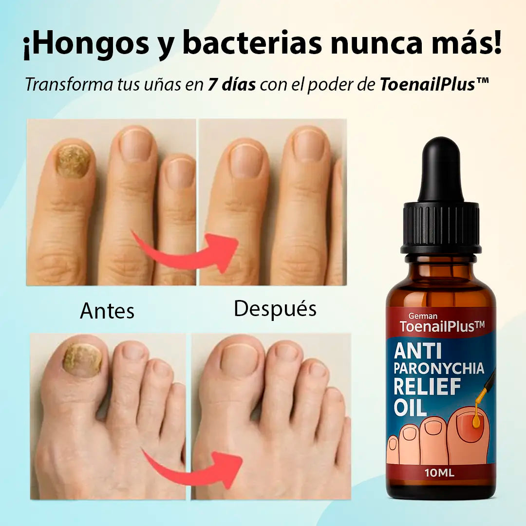 Suero Anti Hongos Relief Oil