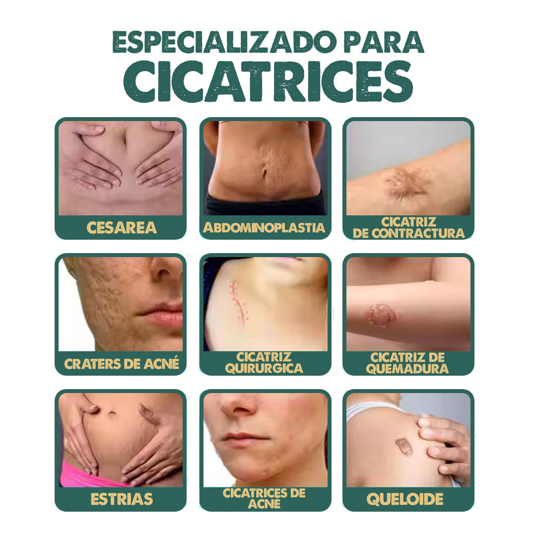 Removedor de Cicatrices en Spray