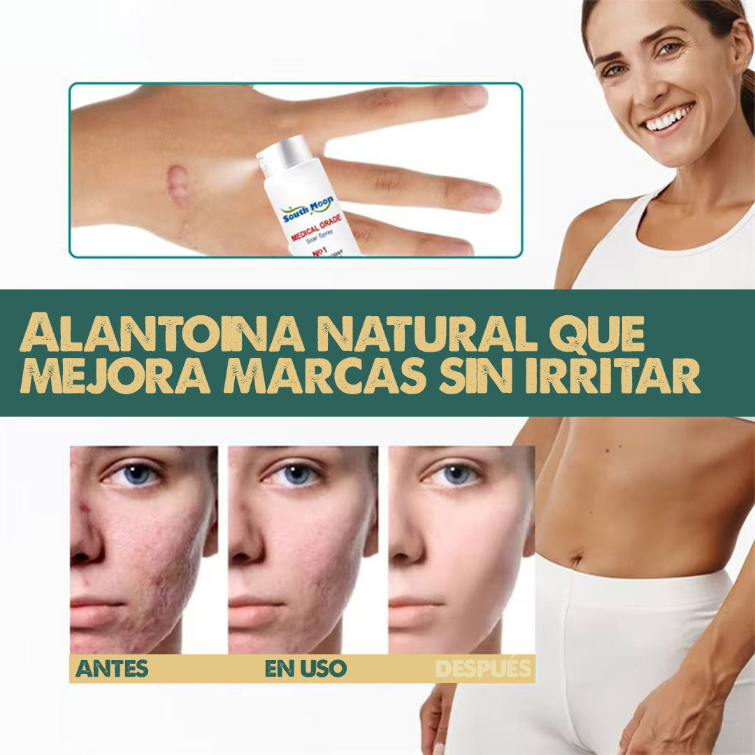 Removedor de Cicatrices en Spray