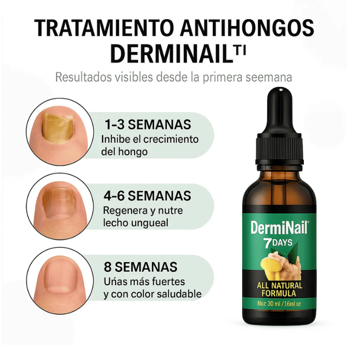 Aceite Anti Hongos Renovador de Uñas