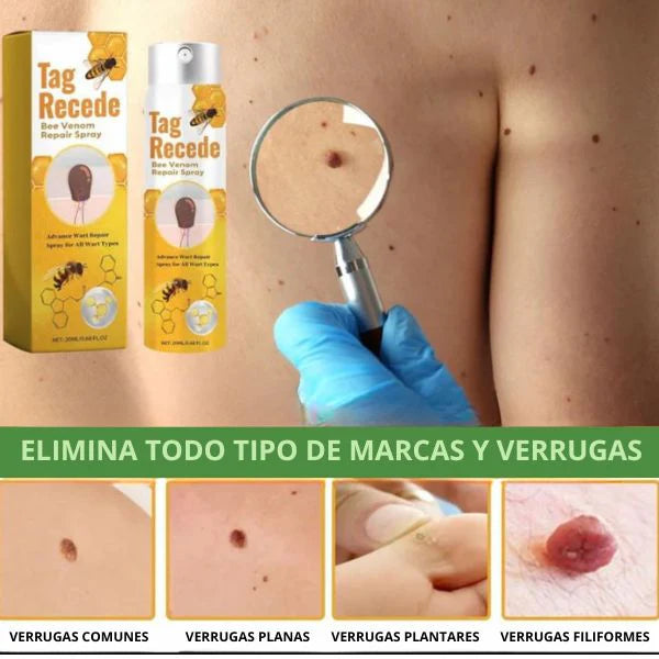 Tag Recede Eliminador de Verrugas